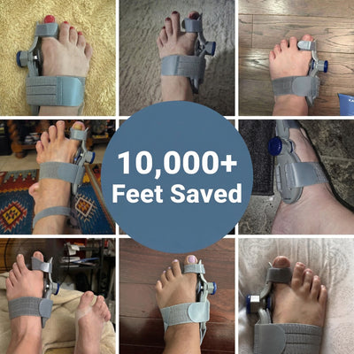 Valora Bunion Corrector
