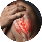 Rotator cuff blessure